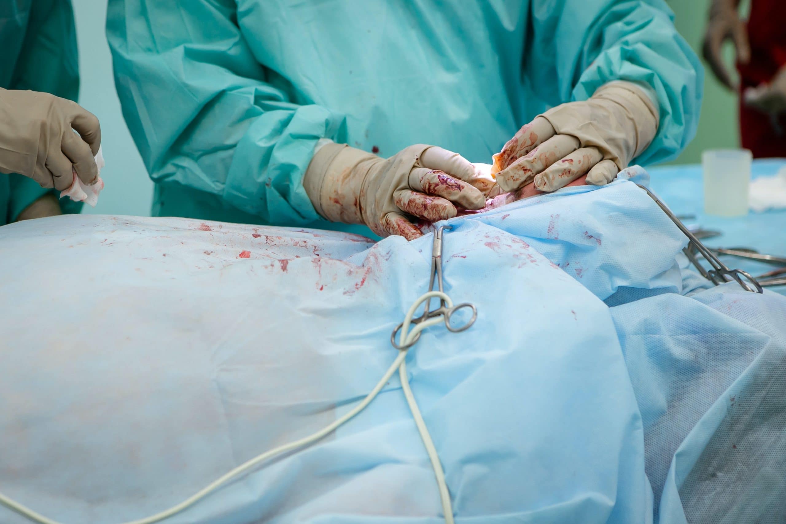 5 Common Medical Malpractice Cases